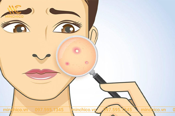 xông hơi da mặt có tác dụng gì